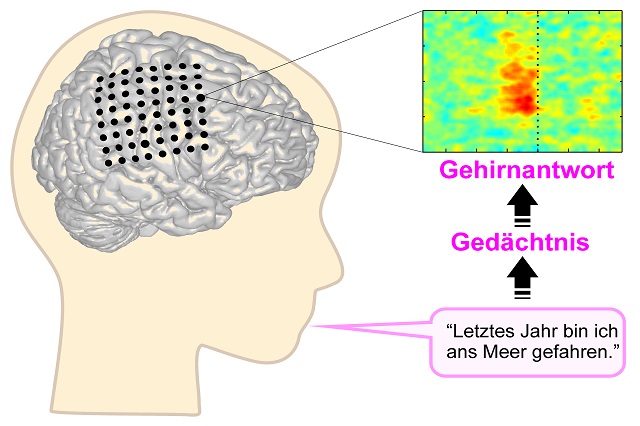 Gehirn, Hirnforschung